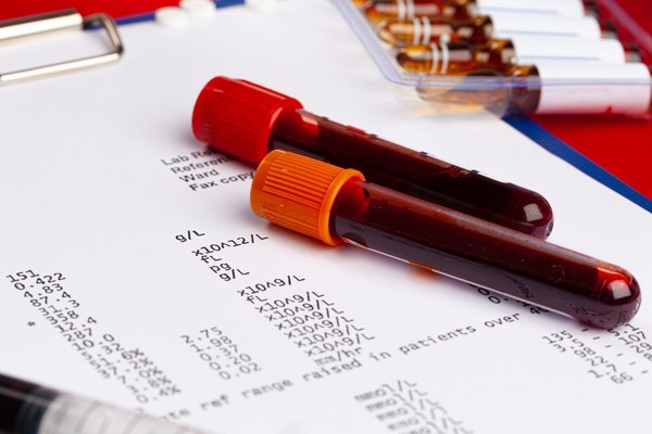 What advanced diagnostic tools are UK pulmonologists using to detect early-stage lung fibrosis?